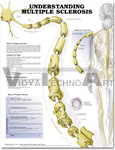 Understanding Multiple Sclerosis Anatomical Chart